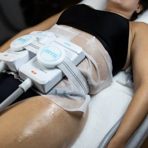 Criolipólisis ARTIX